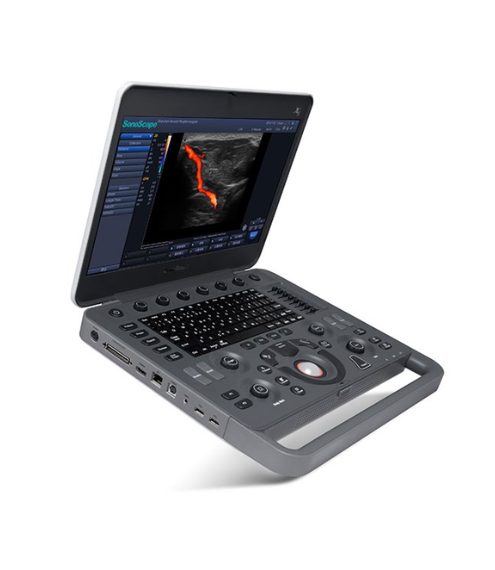 Sonoscape – X5V